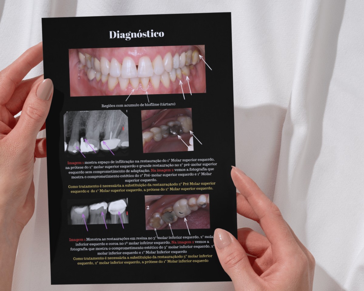 Documento de diagnóstico impresso, com fotografias intraorais, radiografias anotadas e o tratamento indicado para cada região